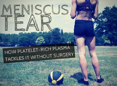 meniscus tear